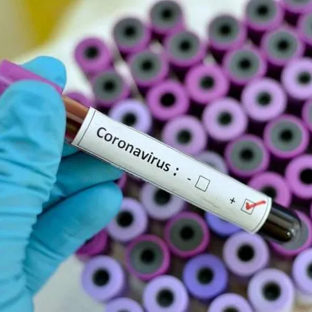 U RS-u preminulo još šest pacijenata koji su bili zaraženi koronavirusom
