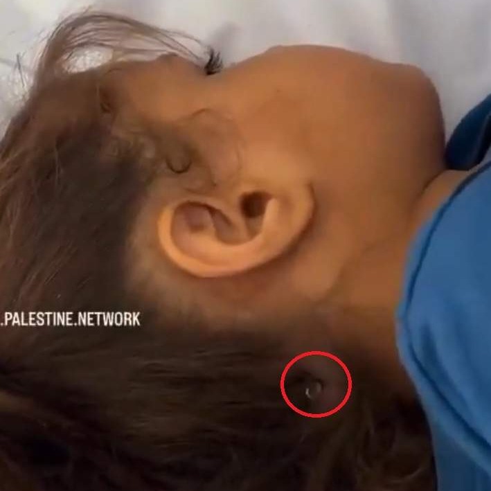 “Samo Izrael građa malene djevojčice u glavu”
