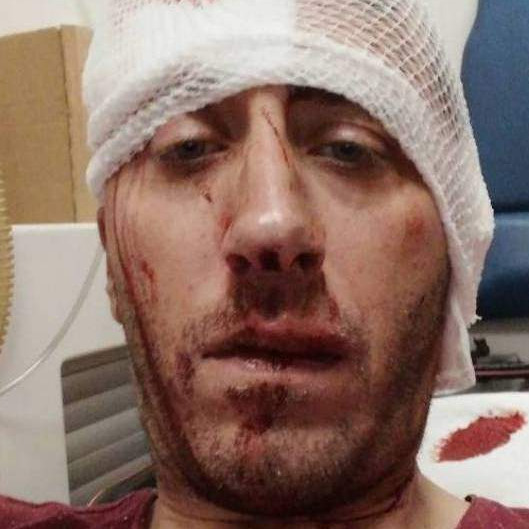 Banja Luka: Brutalno pretučen novinar BN TV Vladimir Kovačević