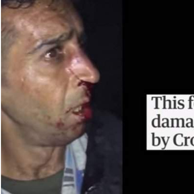 Guardian objavio priču o migrantima koji tvrde da ih je pretukla hrvatska policija 