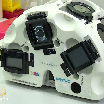 Rusi pripremaju revoluciju u oblast transplantacije ljudskih organa 